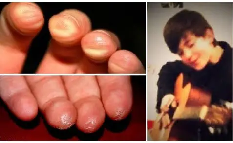 Playing Guitar: How to Deal With Hurting Fingers