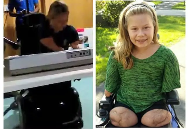 Teenage girl without limbs learns to play the Piano