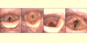 close up of vocal cords while singing